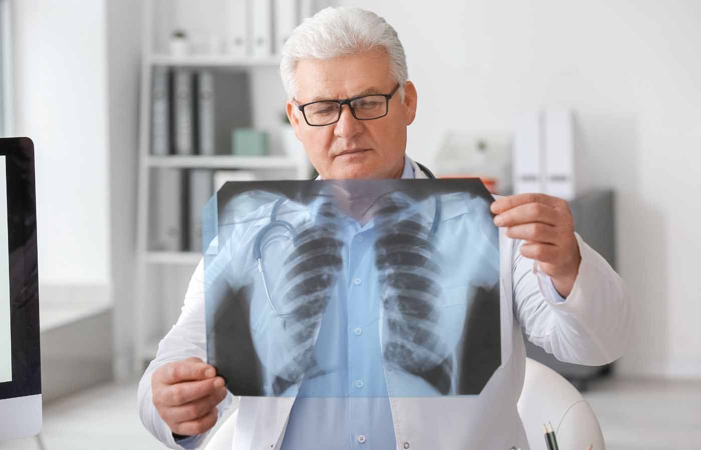 Understanding Different Types of Mesothelioma : Comprehensive Guide