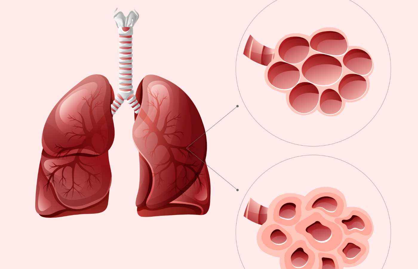 How does a person get mesothelioma?