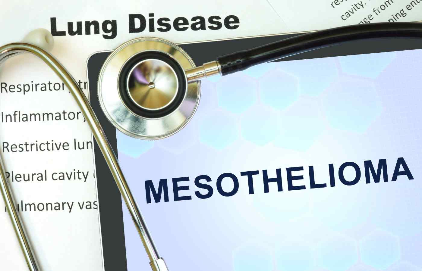 Comprehensive Statistics: Mesothelioma Cases in the United States