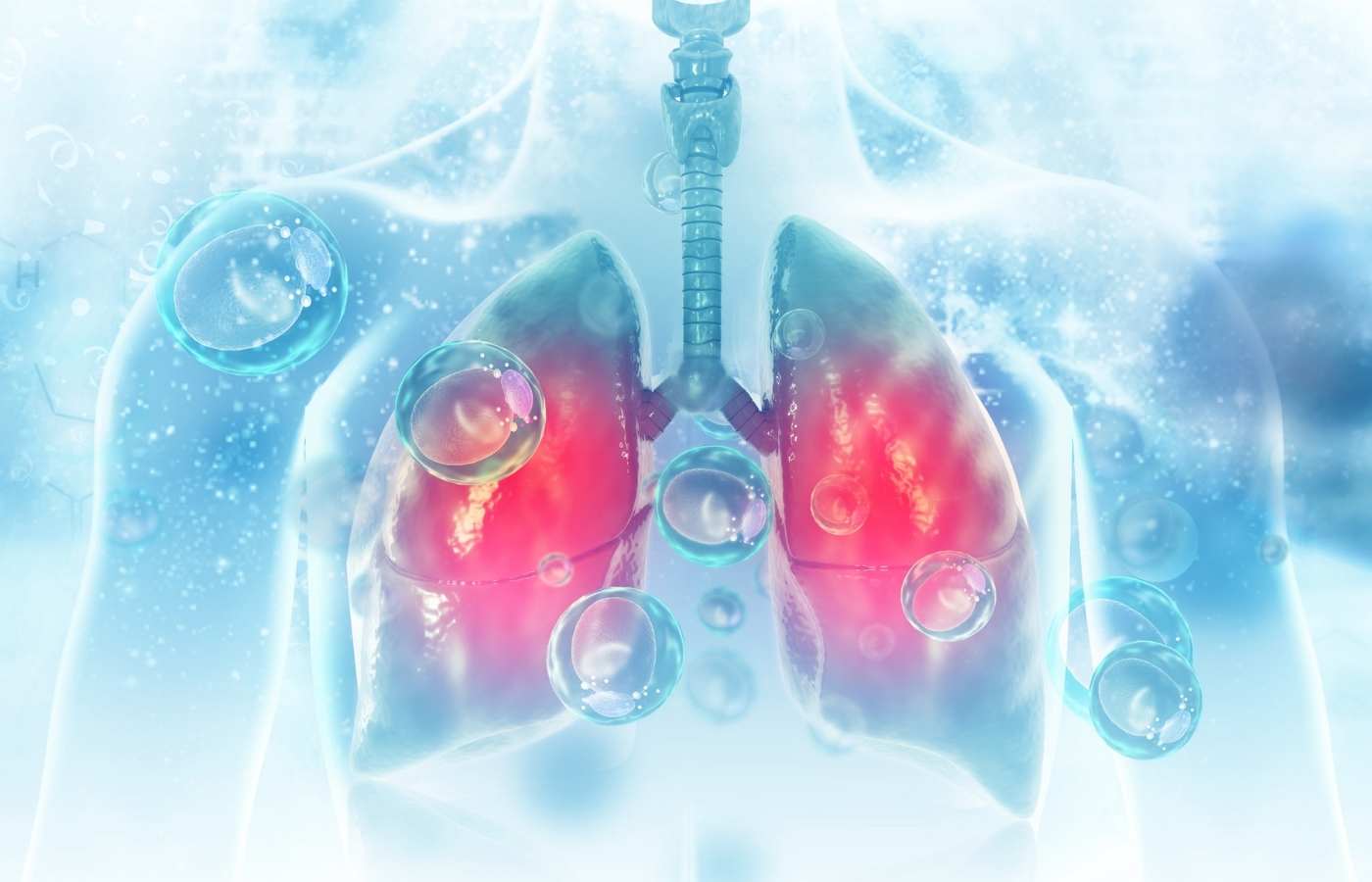 Is Mesothelioma a Carcinoma? : Understanding Carcinomas