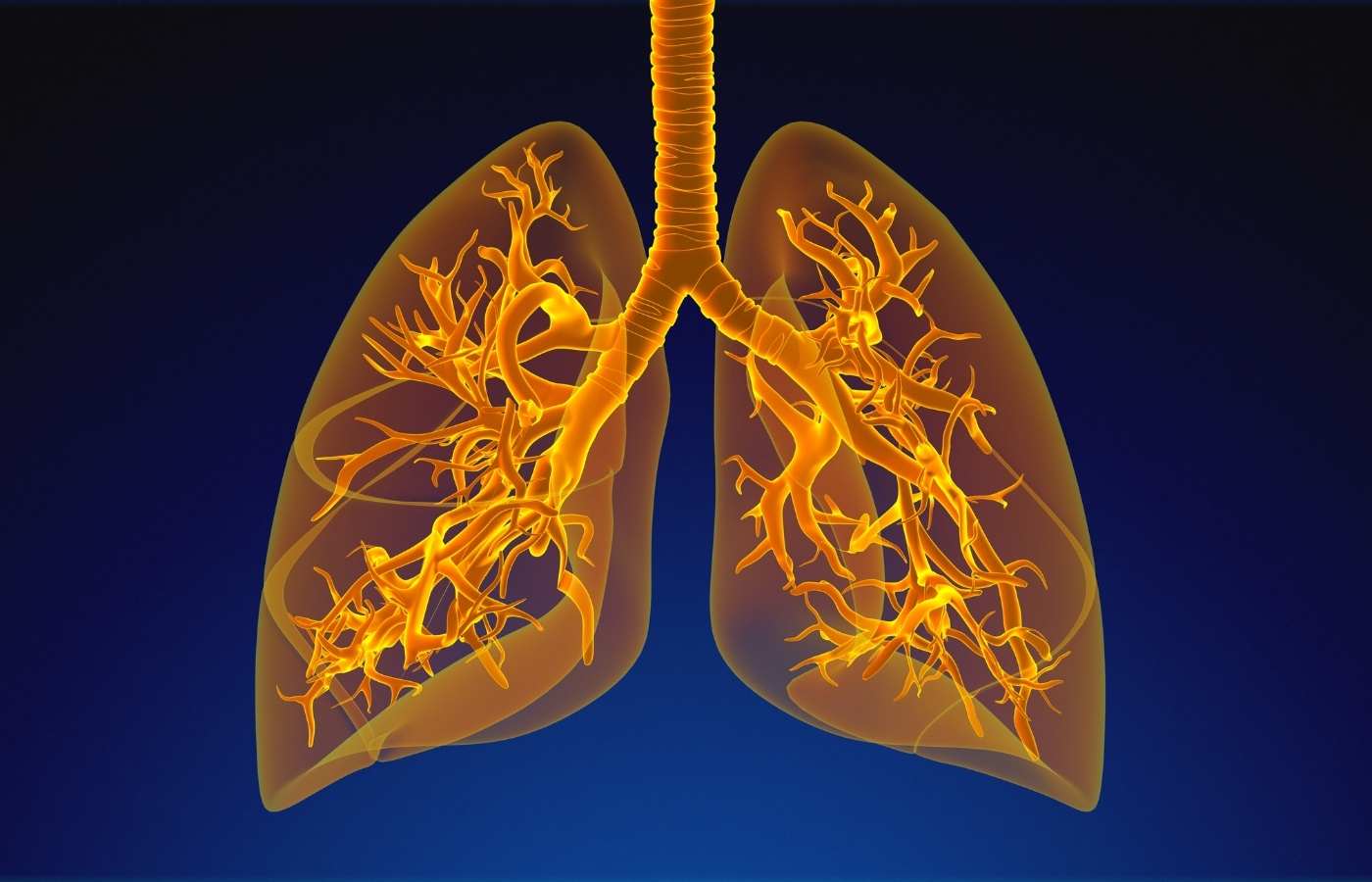 What is the Survival Rate of Malignant Pleural Effusion? : Common Causes