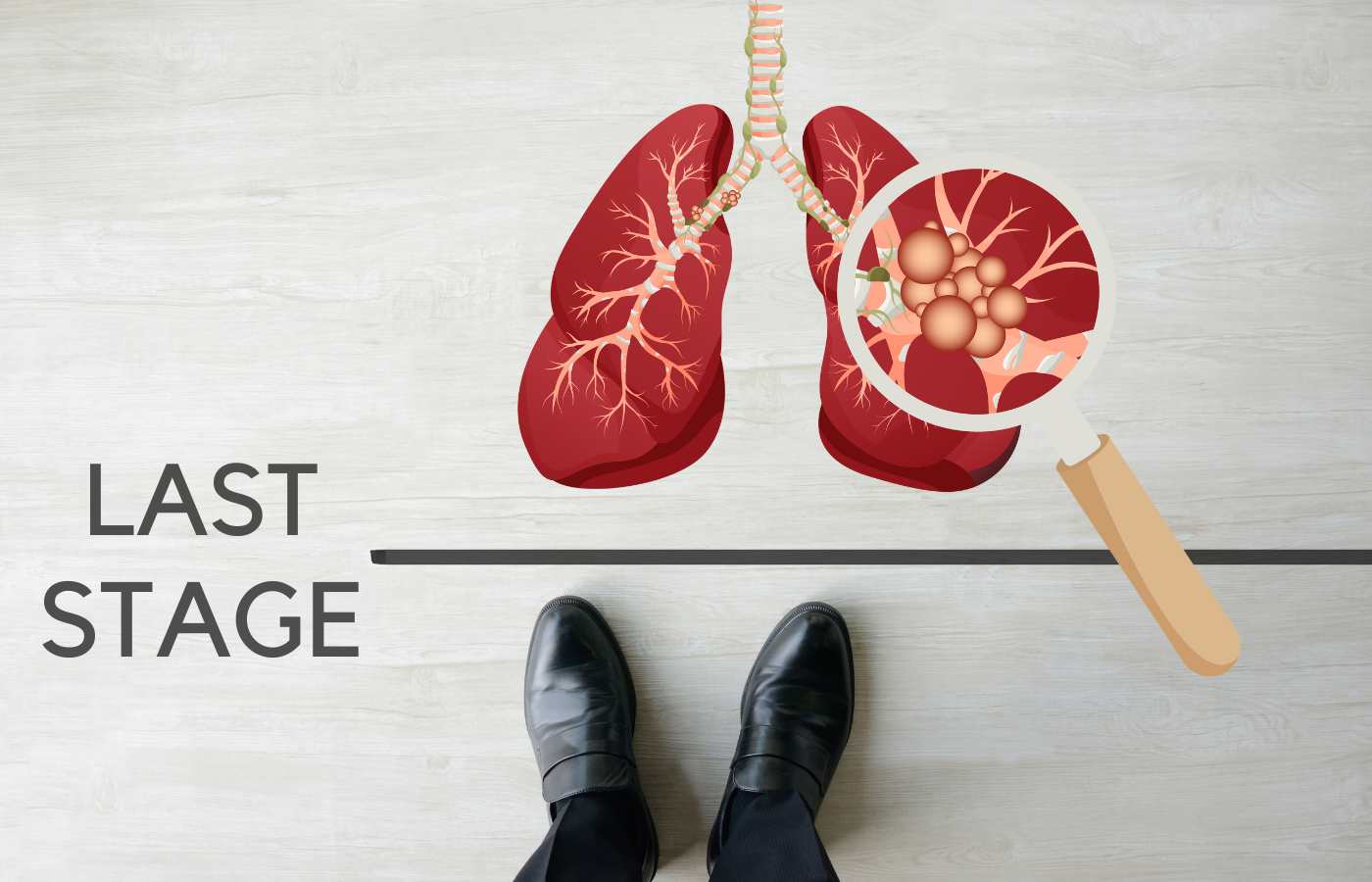 What Are the End Stages of Mesothelioma? : Learn about Progression and Life Expectancy