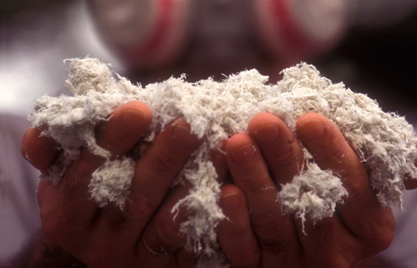 What are the skin symptoms of asbestos exposure : Skin Issues