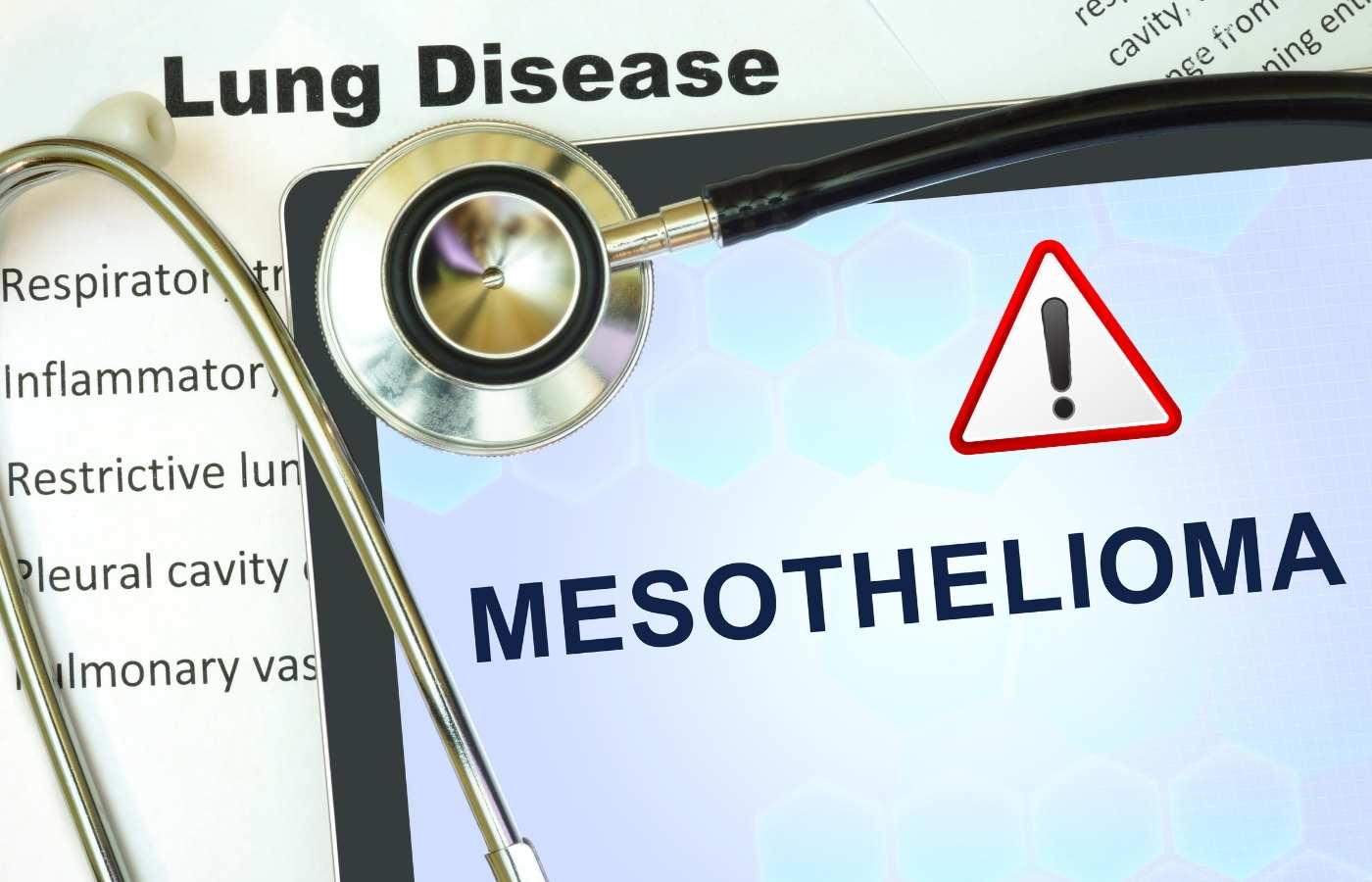 What Are the Warning Signs of Mesothelioma in 2024