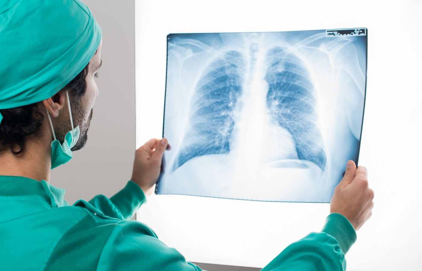 Who is at risk for mesothelioma : Understanding Mesothelioma